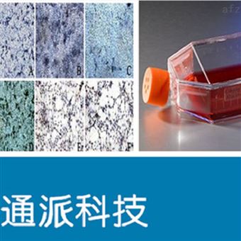 SKOV3细胞（卵巢腺癌细胞 SKOV3培养基）